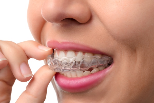 The Invisalign Journey to Your Perfect Smile