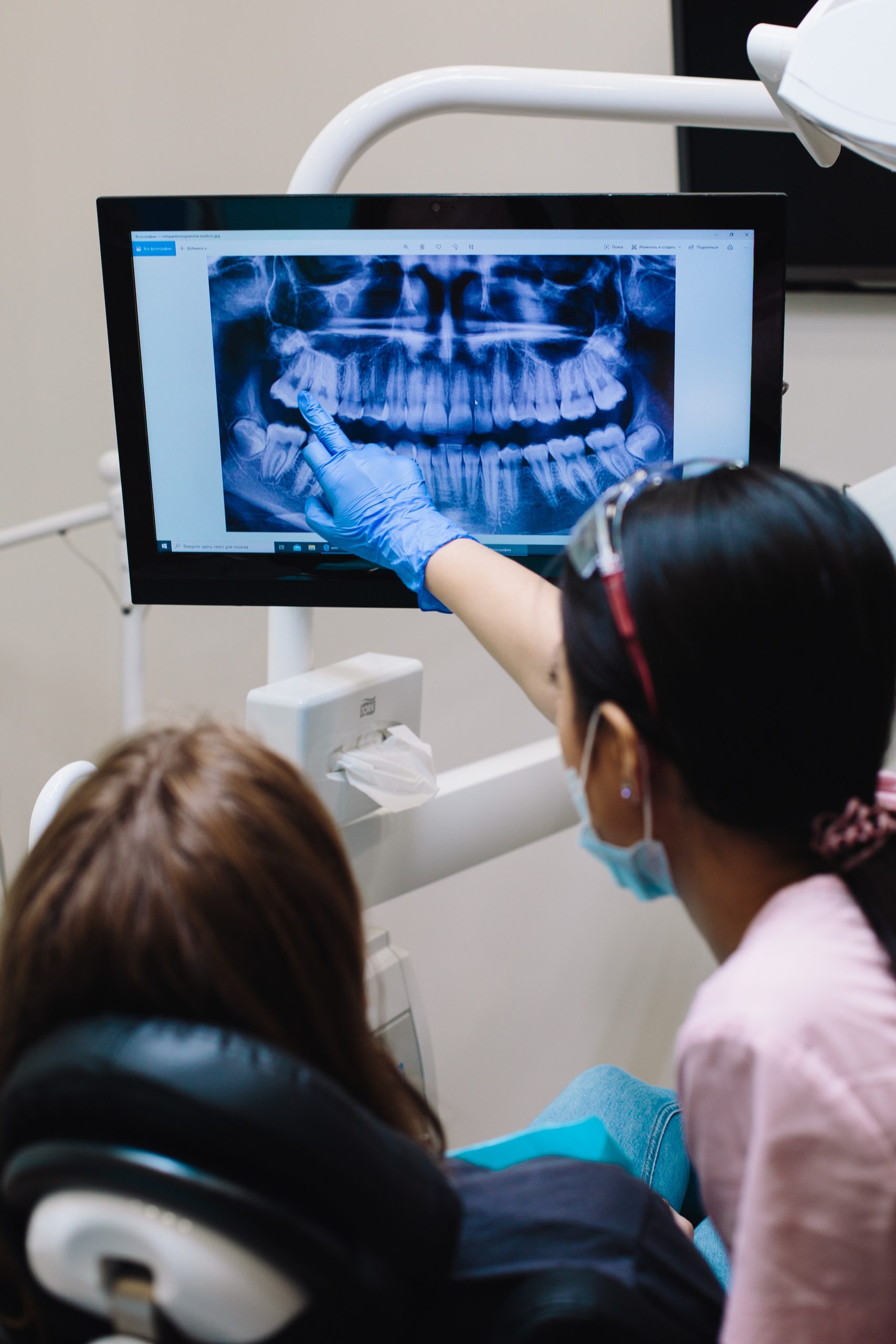 The Benefits of Digital X-Rays